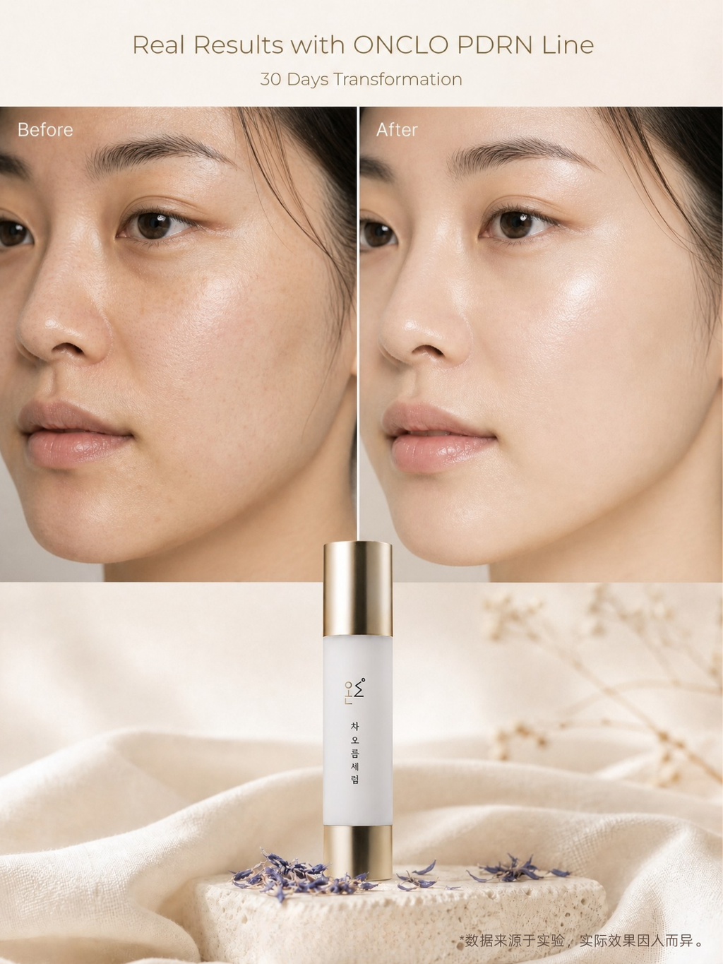 ONCLO CHAOREUM™ PDRN Cream