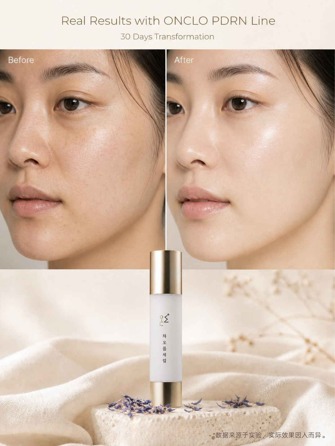 ONCLO CHAOREUM™ PDRN Cream