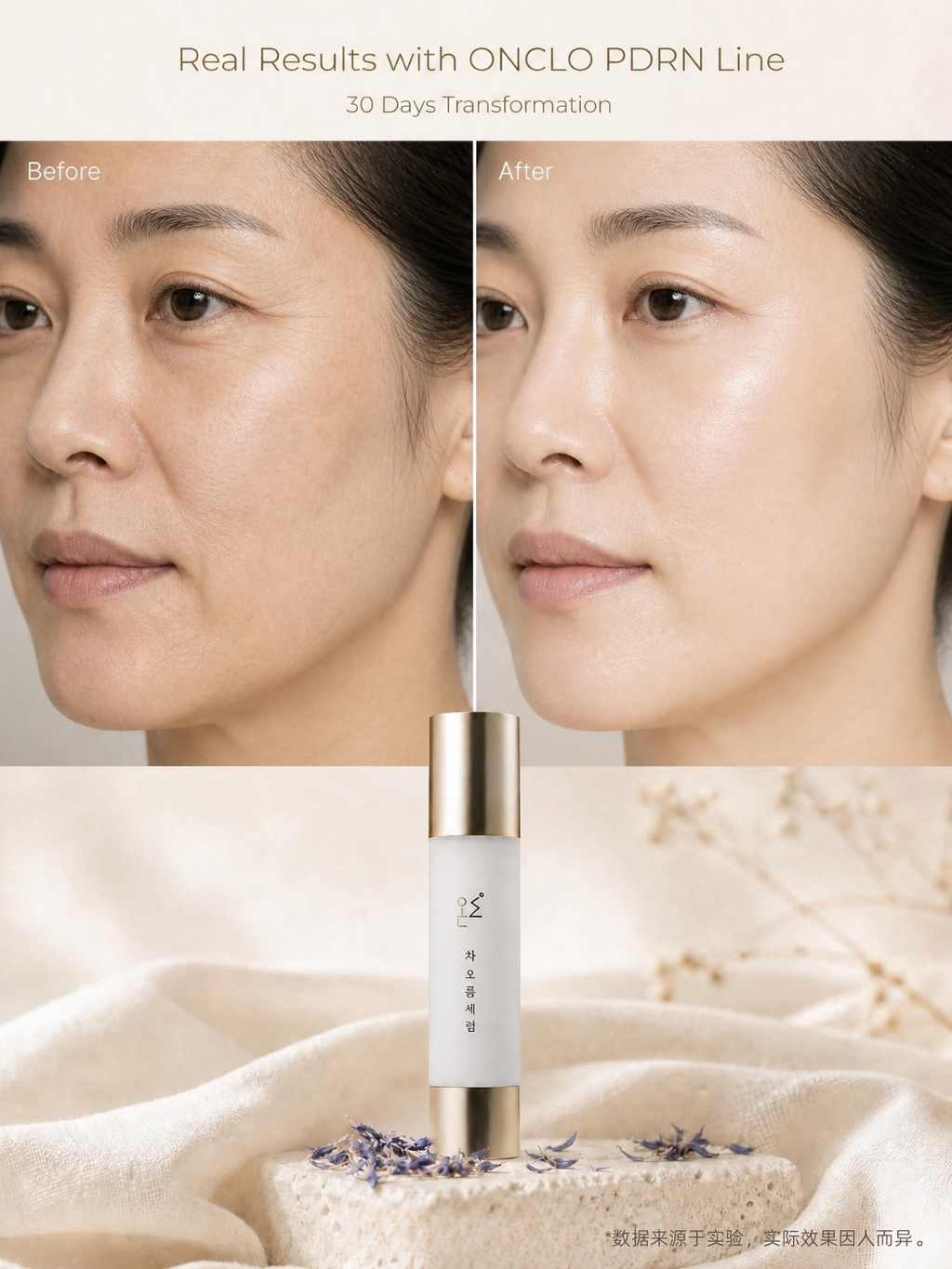 ONCLO CHAOREUM™ PDRN Cream