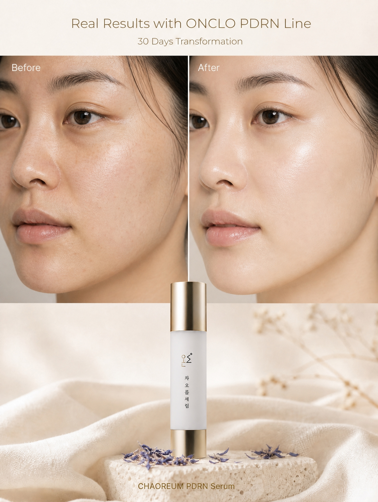ONCLO Chaoreum Serum KR