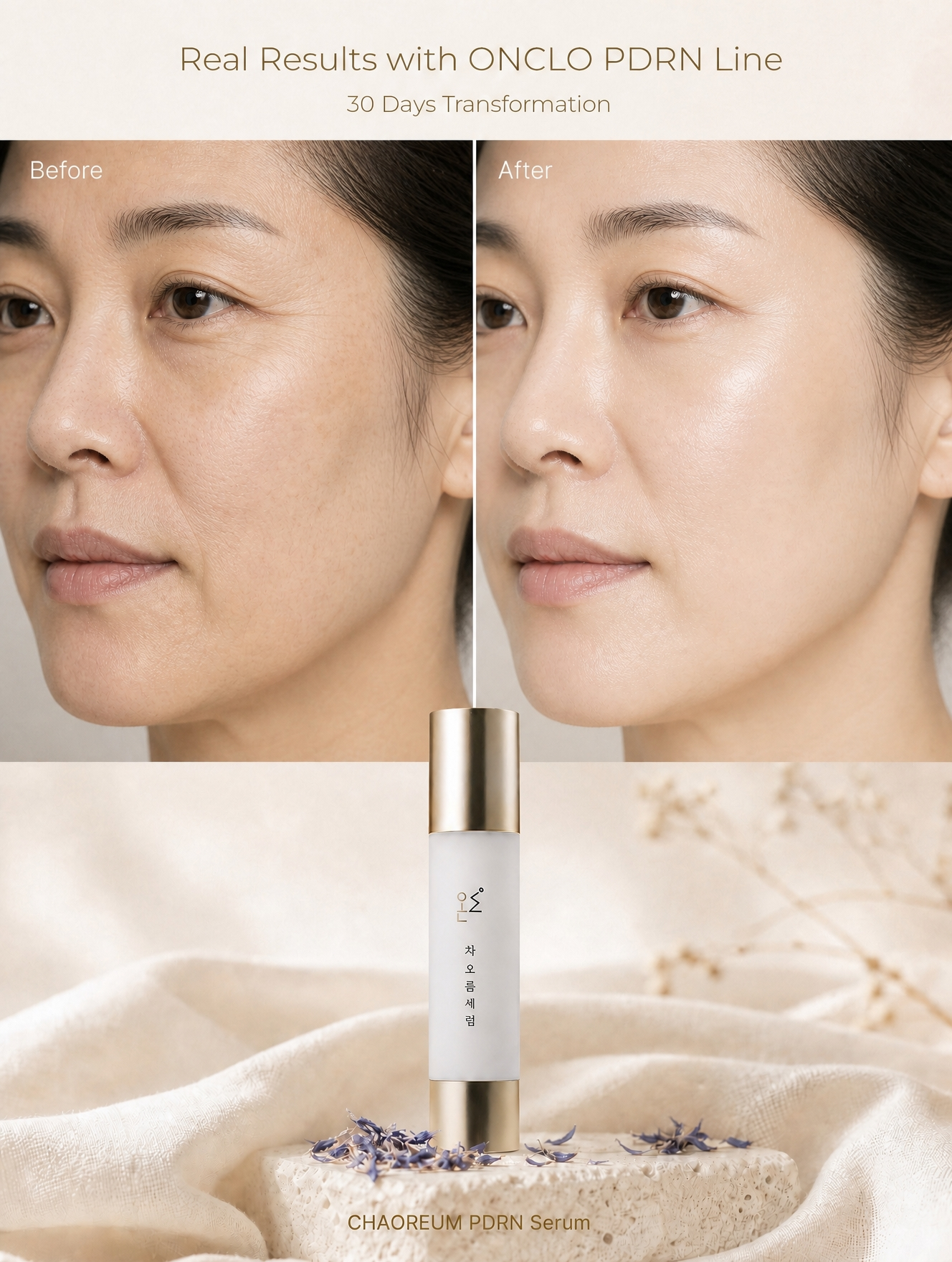 ONCLO Chaoreum Serum KR