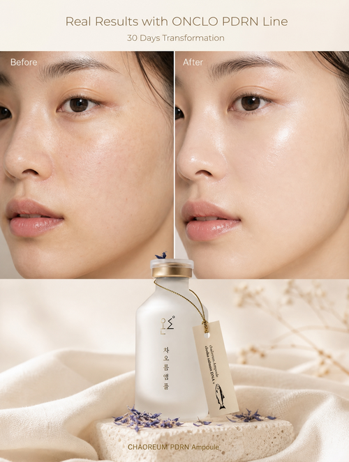 ONCLO Chaoreum Ampoule KR